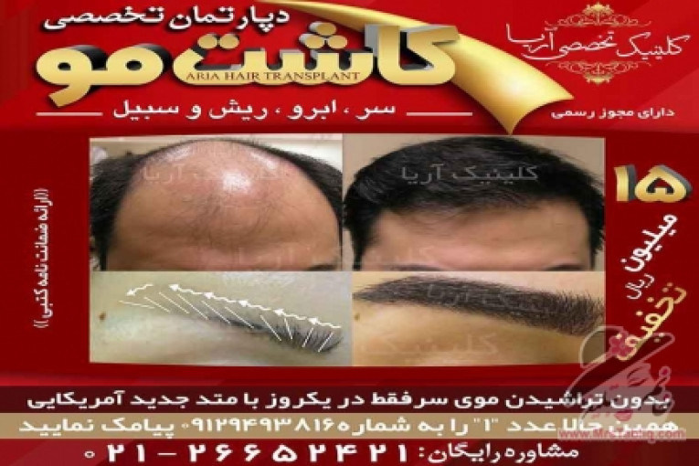 کلینیک فوق تخصصی زیبایی کاشت مو و ابروی آریا