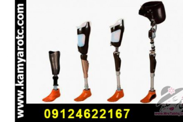 ارتوپدی فنی کامیار | خدمات ارتز و پروتز | پروتزپا | پروتز دست | دست مصنوعی | پای مصنوعی | اسکن پا | کفی طبی | کفش طبی